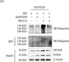 Fig.3.E showing Western Blotting in a Mus musculus (House mouse) sample from the publication: Experimental Validation and Bioinformatics Analysis Elucidate the Role of MTDH-Mediated PTEN Ubiquitination and Degradation in Podocyte Injury in Diabetic Kidney Disease.