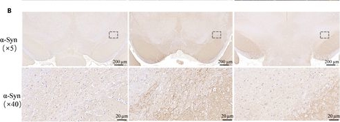 Fig.4.B showing Immunohistochemistry in a Rattus norvegicus (Rat) sample from the publication: Remote Regulation of Molecular Diffusion in Extracellular Space of Parkinson's Disease Rat Model by Subthalamic Nucleus Deep Brain Stimulation.