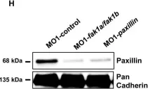 Fig.3.H showing Western Blotting from the publication: Paxillin and Focal Adhesion Kinase (FAK) Regulate Cardiac Contractility in the Zebrafish Heart.