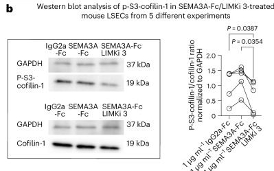 Fig.5.B showing Western Blotting from the publication: Semaphorin-3A regulates liver sinusoidal endothelial cell porosity and promotes hepatic steatosis.