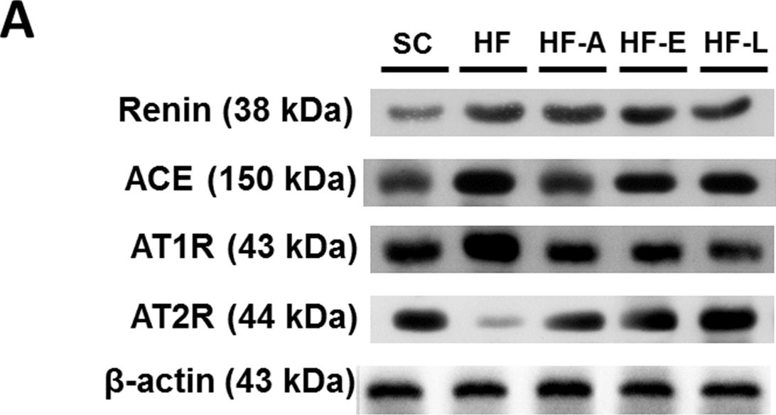 Fig.8.A showing Western Blotting in a Mus musculus (House mouse) sample from the publication: Renin-angiotensin system blockers protect pancreatic islets against diet-induced obesity and insulin resistance in mice.