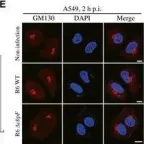 Fig.3.E showing Immunocytochemistry-immunofluorescence from the publication: Streptococcus pneumoniae hijacks host autophagy by deploying CbpC as a decoy for Atg14 depletion.