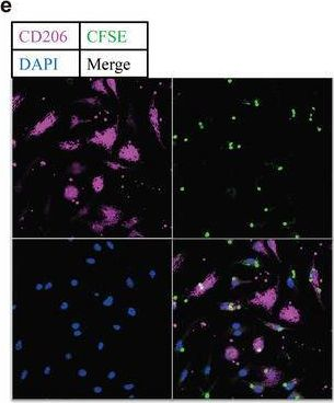 Fig.6.E showing Immunocytochemistry-immunofluorescence from the publication: Sequence Variation of Candida albicans Sap2 Enhances Fungal Pathogenicity via Complement Evasion and Macrophage M2-Like Phenotype Induction.