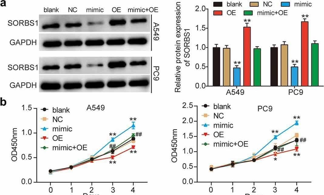 Fig.4.A showing Western Blotting from the publication: MicroRNA miR-3646 promotes malignancy of lung adenocarcinoma cells by suppressing sorbin and SH3 domain-containing protein 1 via the c-Jun NH2-terminal kinase signaling pathway.