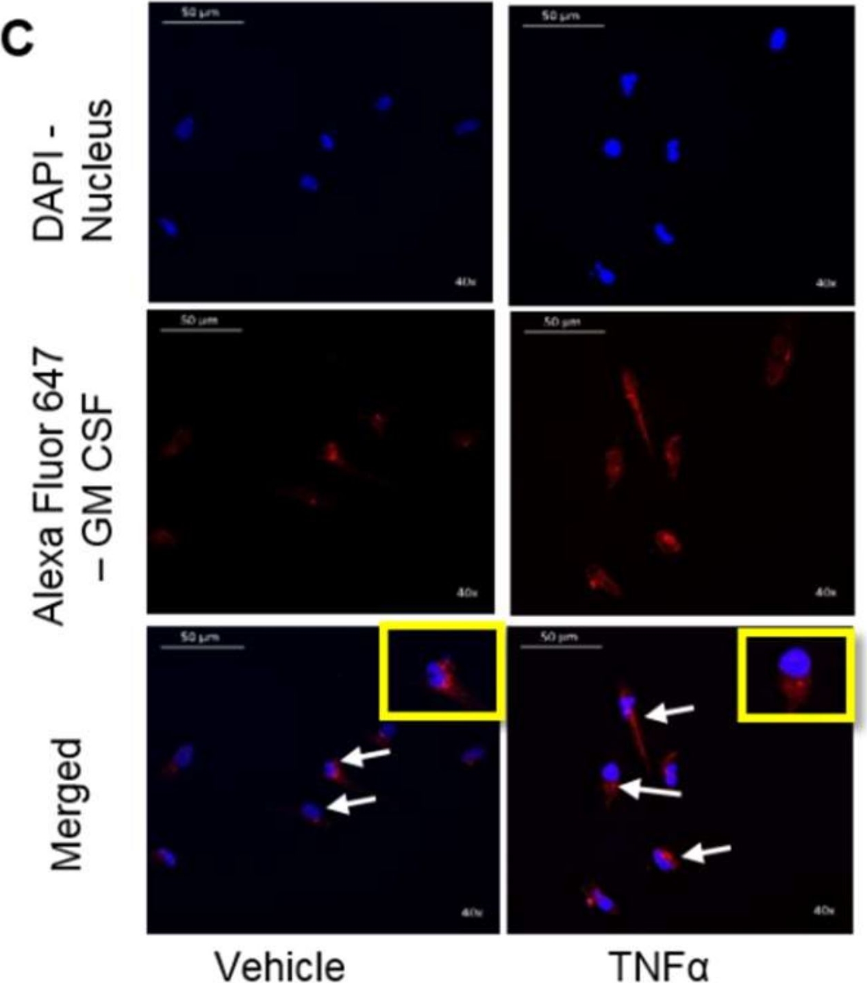 Fig.1.C showing Immunocytochemistry-immunofluorescence in a Homo sapiens (Human) sample from the publication: ACSL1 Regulates TNFα-Induced GM-CSF Production by Breast Cancer MDA-MB-231 Cells.