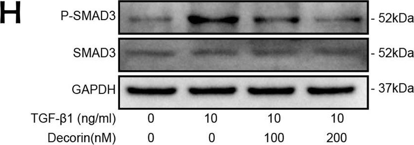 Fig.6.H showing Western Blotting from the publication: Decorin: a potential therapeutic candidate for ligamentum flavum hypertrophy by antagonizing TGF-β1.