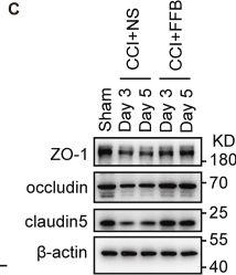 Fig.2.C showing Western Blotting from the publication: Fenofibrate alleviates the brain edema after traumatic brain injury by enhancing endothelial OXPHOS.