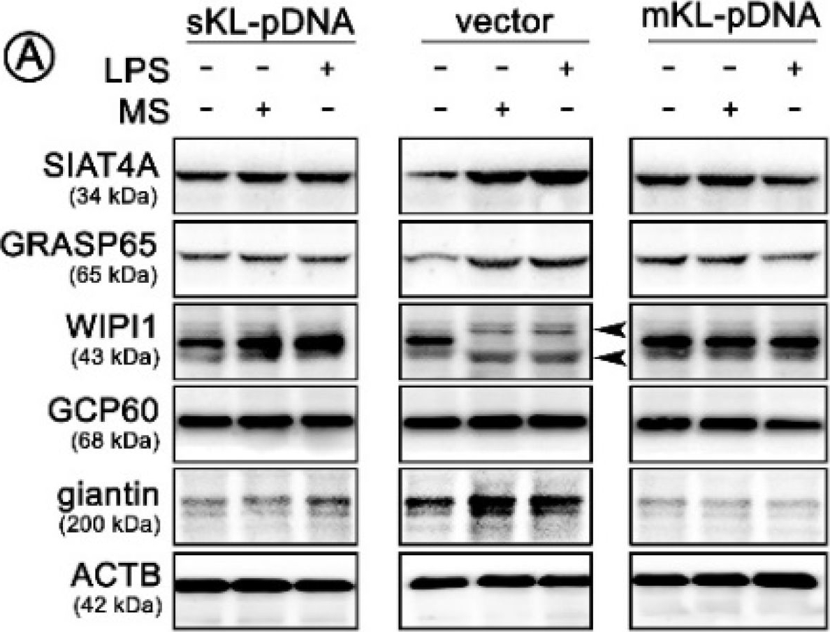 Fig.3.A showing Western Blotting in a Homo sapiens (Human) sample from the publication: Towards Age-Related Anti-Inflammatory Therapy: Klotho Suppresses Activation of ER and Golgi Stress Response in Senescent Monocytes.