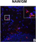 Fig.7.B showing Immunohistochemistry-immunofluorescence in a Mus musculus (House mouse) sample from the publication: IFN-gamma signaling in the central nervous system controls the course of experimental autoimmune encephalomyelitis independently of the localization and composition of inflammatory foci.