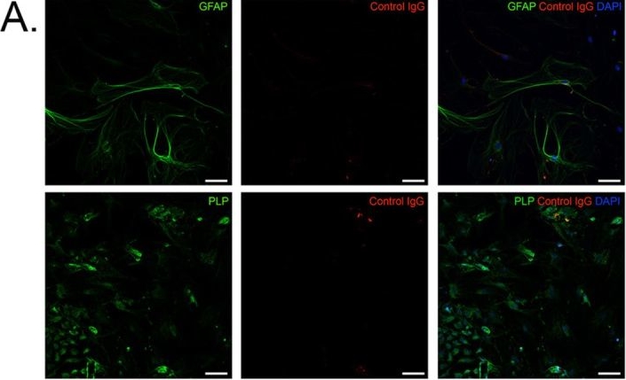 Fig.4.A showing Immunohistochemistry-immunofluorescence in a Mus musculus (House mouse) sample from the publication: Immunization With Bovine Milk Casein Results in Enteric Nervous System Pathology in a Mouse Model of Neuroinflammation.