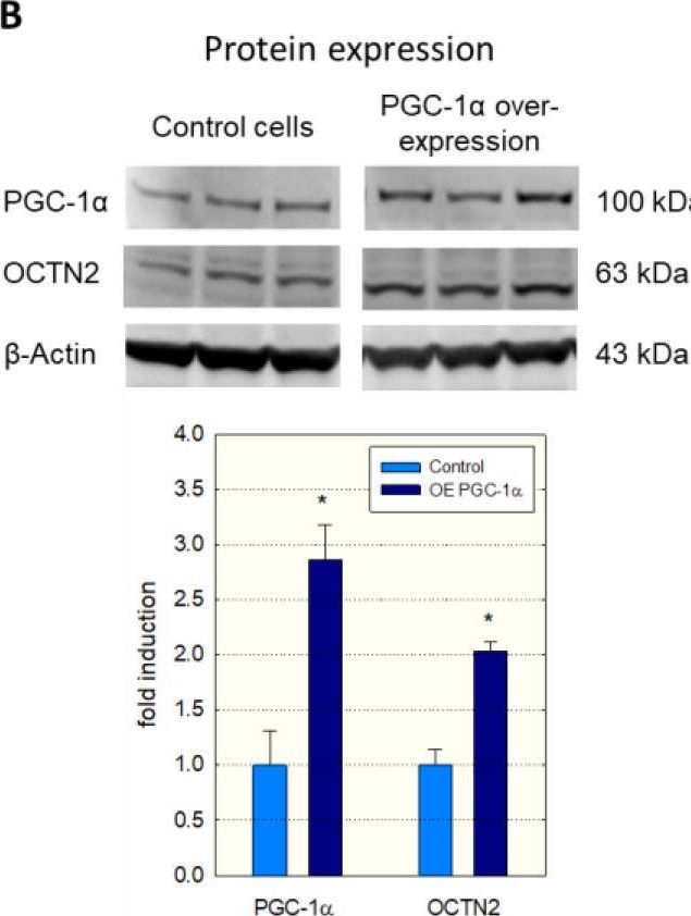 Fig.1.B showing Western Blotting from the publication: PGC-1α and MEF2 Regulate the Transcription of the Carnitine Transporter OCTN2 Gene in C2C12 Cells and in Mouse Skeletal Muscle.