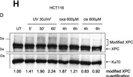 Fig.2.H showing Western Blotting in a Homo sapiens (Human) sample from the publication: Detection of oxaliplatin- and cisplatin-DNA lesions requires different global genome repair mechanisms that affect their clinical efficacy.