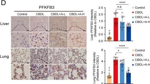 Fig.5.D showing Immunohistochemistry from the publication: Agrimoniin ameliorates intrapulmonary angiogenesis and improves hypoxemia in hepatopulmonary syndrome via PGC-1α activation and glycolysis down-regulation.