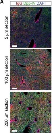 Fig.1.A showing Immunohistochemistry-immunofluorescence from the publication: Optimized immunofluorescence for liver structure analysis: Enhancing 3D resolution and minimizing tissue autofluorescence.