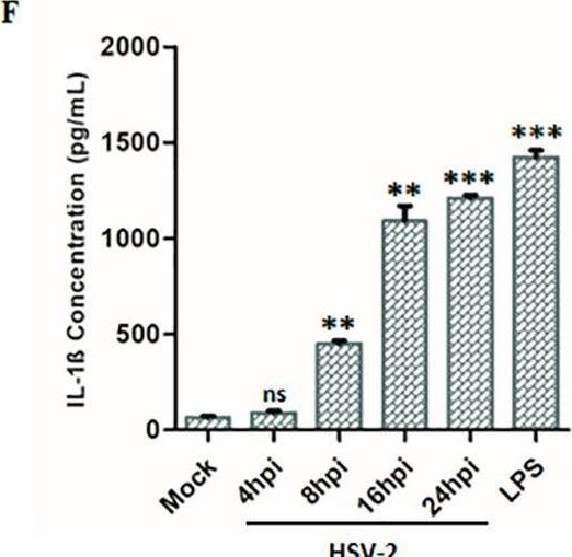 Fig.2.F showing Enzyme-linked immunosorbent assay in a Homo sapiens (Human) sample from the publication: MicroRNAs as regulators of NLRP3 inflammasome activation in herpes simplex virus type 2 infection.