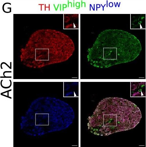 Fig.1.G showing Immunohistochemistry-immunofluorescence in a Mus musculus (House mouse) sample from the publication: Tiered sympathetic control of cardiac function revealed by viral tracing and single cell transcriptome profiling.