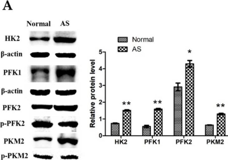 Fig.4.A showing Western Blotting in a Gallus gallus domesticus (Chicken) sample from the publication: Changes in the Expression of MIF and Other Key Enzymes of Energy Metabolism in the Myocardia of Broiler Chickens with Ascites Syndrome.