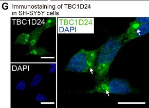 Fig.1.G showing Immunocytochemistry-immunofluorescence from the publication: Gm14230 controls Tbc1d24 cytoophidia and neuronal cellular juvenescence.