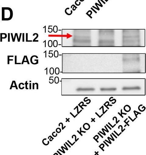 Fig.5.D showing Western Blotting in a Homo sapiens (Human) sample from the publication: PIWIL2 downregulation in colon cancer promotes transposon activity and pro-tumorigenic phenotypes.