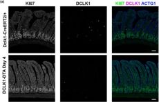 Ki-67 (D3B5) Rabbit Monoclonal Antibody (Alexa Fluor® 488