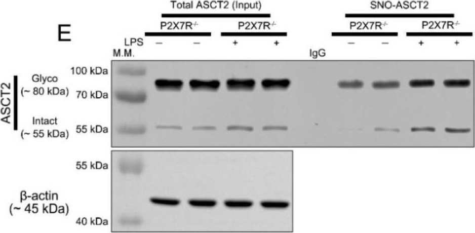 Fig.8.E showing Western Blotting in a Mus musculus (House mouse) sample from the publication: P2X7 Receptor Augments LPS-Induced Nitrosative Stress by Regulating Nrf2 and GSH Levels in the Mouse Hippocampus.
