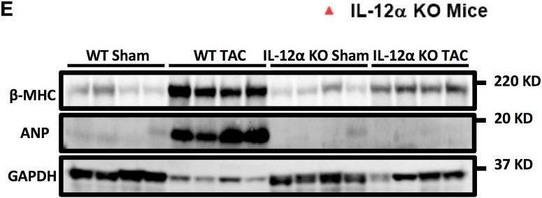 Fig.1.E showing Western Blotting from the publication: IL-12α deficiency attenuates pressure overload-induced cardiac inflammation, hypertrophy, dysfunction, and heart failure progression.
