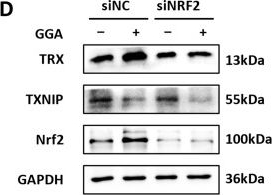 Fig.6.D showing Western Blotting in a Mus musculus (House mouse) sample from the publication: Geranylgeranylacetone Ameliorates Skin Inflammation by Regulating and Inducing Thioredoxin via the Thioredoxin Redox System.