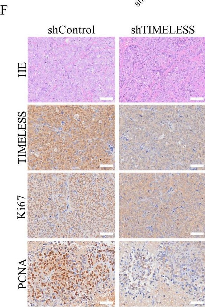 Fig.3.F showing Immunohistochemistry in a Mus musculus (House mouse) sample from the publication: TIMELESS promotes reprogramming of glucose metabolism in oral squamous cell carcinoma.