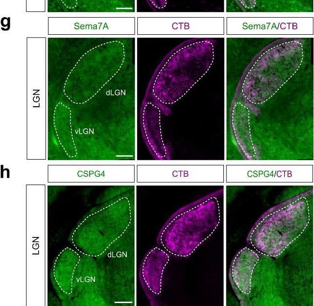 Fig.2.G showing Immunohistochemistry-immunofluorescence from the publication: Guidance landscapes unveiled by quantitative proteomics to control reinnervation in adult visual system.