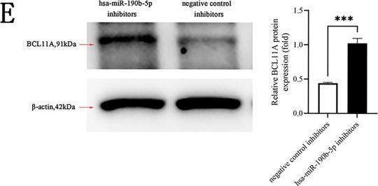 Fig.6.E showing Western Blotting in a Homo sapiens (Human) sample from the publication: The clinical value of hsa-miR-190b-5p in peripheral blood of pediatric β-thalassemia and its regulation on BCL11A expression.