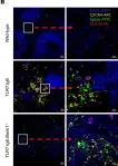 Fig.7.B showing Immunohistochemistry-immunofluorescence in a Mus musculus (House mouse) sample from the publication: Bank1 modulates the differentiation and molecular profile of key B cell populations in autoimmunity.