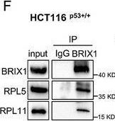 Fig.4.F showing Western Blotting in a Homo sapiens (Human) sample from the publication: Targeting BRIX1 via Engineered Exosomes Induces Nucleolar Stress to Suppress Cancer Progression.
