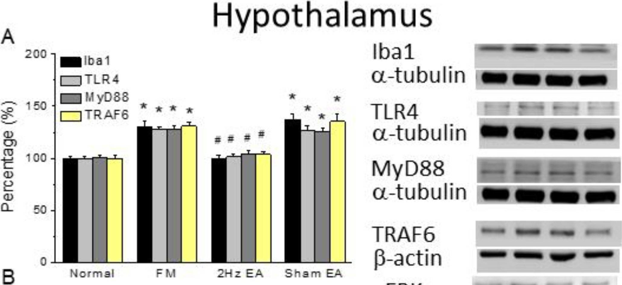 Fig.2.A showing Western Blotting in a Mus musculus (House mouse) sample from the publication: Electroacupuncture Attenuates Fibromyalgia Pain via Toll-like Receptor 4 in the Mouse Brain.