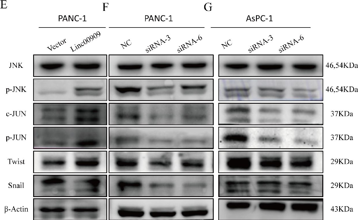 Fig.3.E showing Western Blotting in a Homo sapiens (Human) sample from the publication: LINC00909 up-regulates pluripotency factors and promotes cancer stemness and metastasis in pancreatic ductal adenocarcinoma by targeting SMAD4.