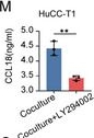 Fig.8.M showing Enzyme-linked immunosorbent assay from the publication: Role of Tunneling Nanotubes in Arachidonic Acid Transfer and Macrophage Function Reprogramming in Intrahepatic Cholangiocarcinoma.