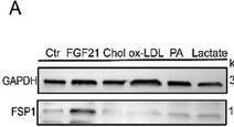 Fig.4.A showing Western Blotting in a Mus musculus (House mouse) sample from the publication: TEAD1-Mediated Trans-Differentiation of Vascular Smooth Muscle Cells into Fibroblast-Like Cells Contributes to the Stabilization and Repair of Disrupted Atherosclerotic Plaques.