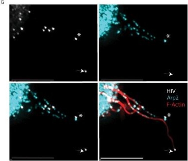 Fig.4.G showing Immunohistochemistry in a Homo sapiens (Human) sample from the publication: Mobilization of HIV spread by diaphanous 2 dependent filopodia in infected dendritic cells.