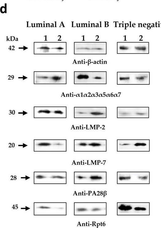 Fig.4.D showing Western Blotting in a Homo sapiens (Human) sample from the publication: Association of Proteasome Activity and Pool Heterogeneity with Markers Determining the Molecular Subtypes of Breast Cancer.