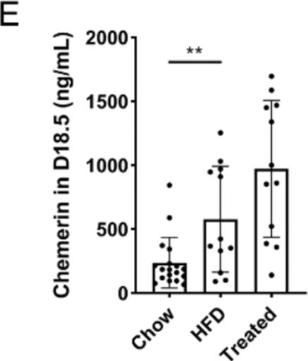 Fig.6.E showing Enzyme-linked immunosorbent assay from the publication: Chemerin alleviates the placental oxidative stress and improves fetal overgrowth of gestational diabetes mellitus mice induced by high fat diet.