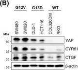 Fig.3.B showing Western Blotting from the publication: Basroparib inhibits YAP-driven cancers by stabilizing angiomotin.