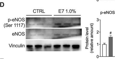 Fig.5.D showing Western Blotting in a Homo sapiens (Human) sample from the publication: Essential amino acids preserve intestinal barrier integrity via mitochondrial protection in obesity and gut inflammation.
