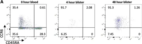 Fig.4.A showing Flow cytometry/Cell sorting from the publication: A novel Streptococcus pneumoniae human challenge model demonstrates Treg lymphocyte recruitment to the infection site.
