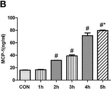 Fig.5.B showing Enzyme-linked immunosorbent assay from the publication: Neutrophil-Derived IL-17 Promotes Ventilator-Induced Lung Injury via p38 MAPK/MCP-1 Pathway Activation.