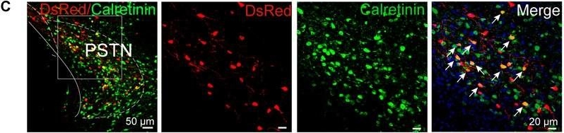 Fig.5.C showing Immunohistochemistry-immunofluorescence in a Mus musculus (House mouse) sample from the publication: Whole-Brain Neural Connectivity to Lateral Pontine Tegmentum GABAergic Neurons in Mice.