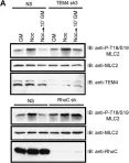 Fig.6.A showing Western Blotting in a Homo sapiens (Human) sample from the publication: The RhoGEF TEM4 Regulates Endothelial Cell Migration by Suppressing Actomyosin Contractility.