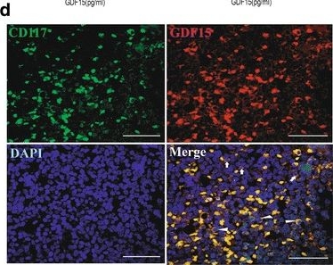 Fig.5.D showing Immunohistochemistry-immunofluorescence in a Homo sapiens (Human) sample from the publication: Growth differentiation factor 15 contributes to marrow adipocyte remodeling in response to the growth of leukemic cells.