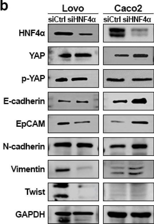 Fig.5.B showing Western Blotting in a Homo sapiens (Human) sample from the publication: Dual Role of HNF4α in Colorectal Adenocarcinoma During Carcinogenesis and Metastasis.
