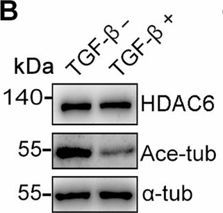 Fig.5.B showing Western Blotting in a Mus musculus (House mouse) sample from the publication: CYLD/HDAC6 signaling regulates the interplay between epithelial-mesenchymal transition and ciliary homeostasis during pulmonary fibrosis.