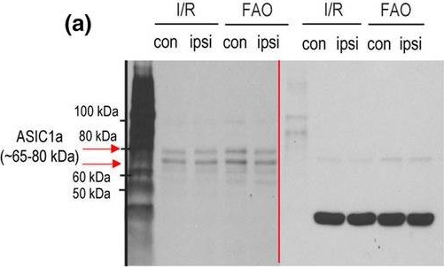 Fig.2.A showing Western Blotting in a Rattus norvegicus (Rat) sample from the publication: NGF contributes to activities of acid-sensing ion channels in dorsal root ganglion neurons of male rats with experimental peripheral artery disease.