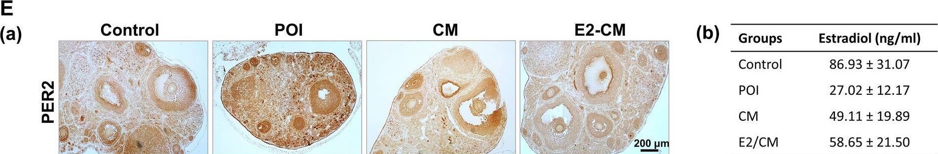 Fig.5.E showing Immunohistochemistry from the publication: Secretome from estrogen-responding human placenta-derived mesenchymal stem cells rescues ovarian function and circadian rhythm in mice with cyclophosphamide-induced primary ovarian insufficiency.